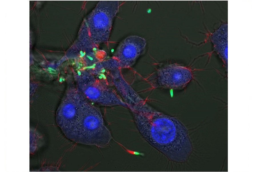Scientists use nanoparticles to kill bugs